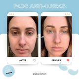 Pads Anti Ojeras Hidrogel Rebel Skin™ - Rebel
